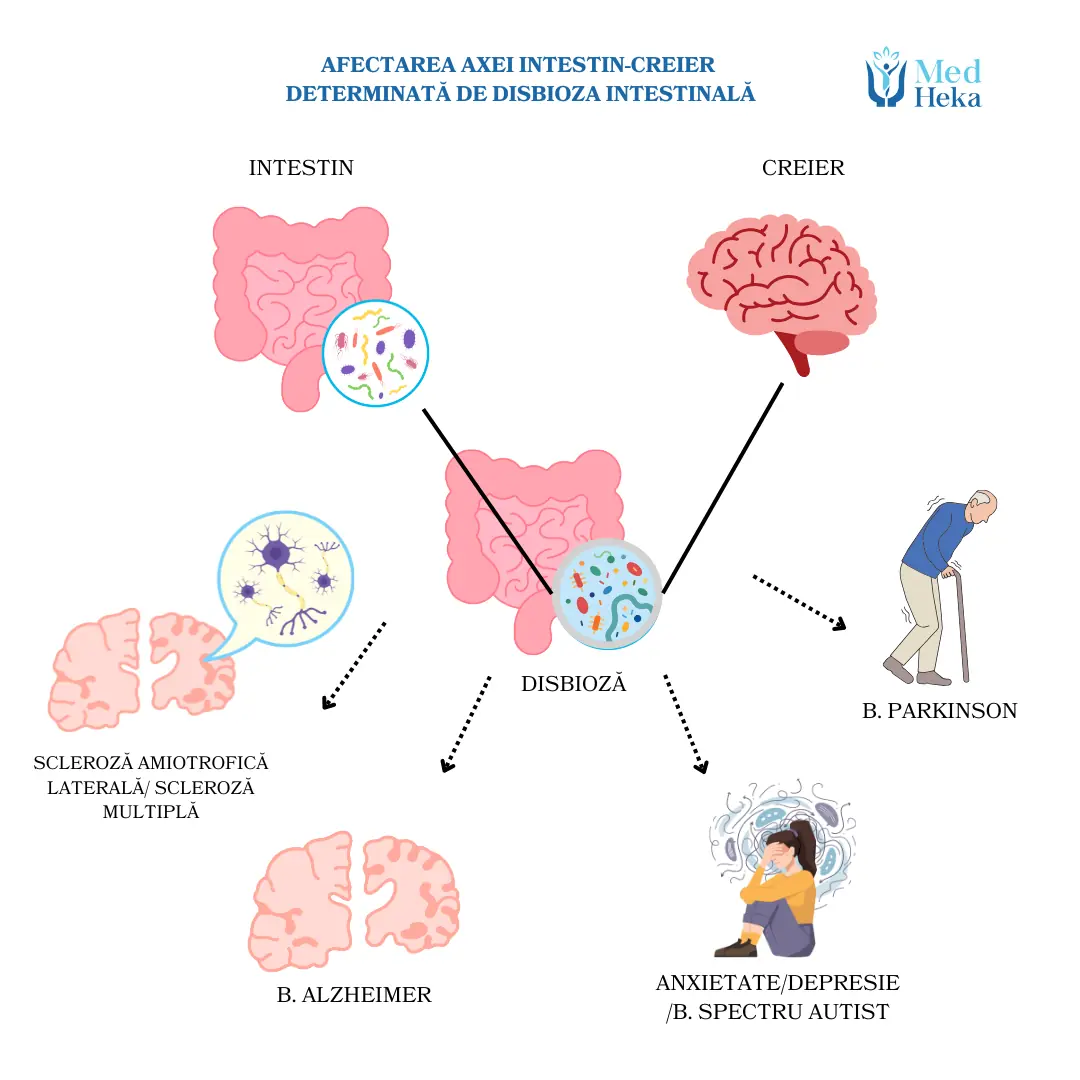 AXA-INTESTIN-CREIER-medheka-ro_-opt.webp